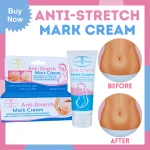 Aichun Beauty Anti Stretch Mark Cream – 60g - Image 2