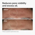 The Ordinary Niacinamide 10% + Zinc 1% 30ml - Image 4